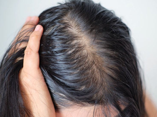 Capelli e stress: come proteggere la nostra chioma