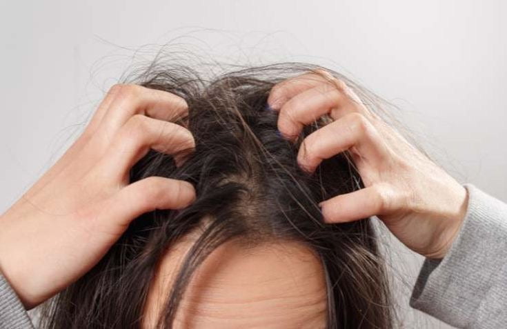 Dermatite atopica del cuoio capelluto: cause, sintomi e trattamenti efficaci