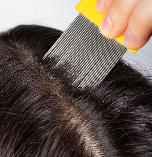 Pidocchi dei Capelli nei Bambini: Cosa Fare Quando Arrivano a Scuola?
